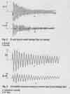 Transient leakage flux measurements on a small universal motor